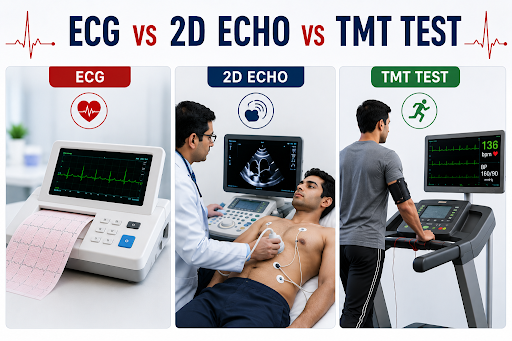 ECG vs 2D Echo vs TMT Test Which Heart Test Do You Actually Need